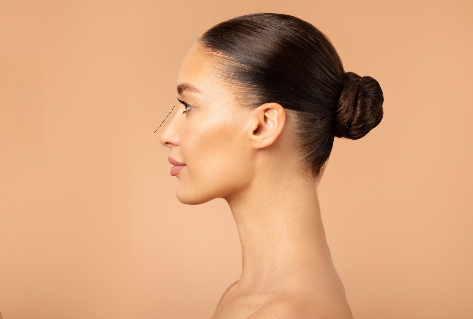 Ultrasonic (Piezo) Rhinoplasty