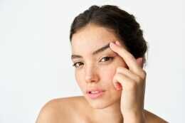 Brow Lift & Temple Lift Surgery