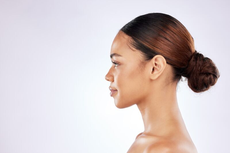 Endoskopisches Deep-Plane-Facelifting Typ I