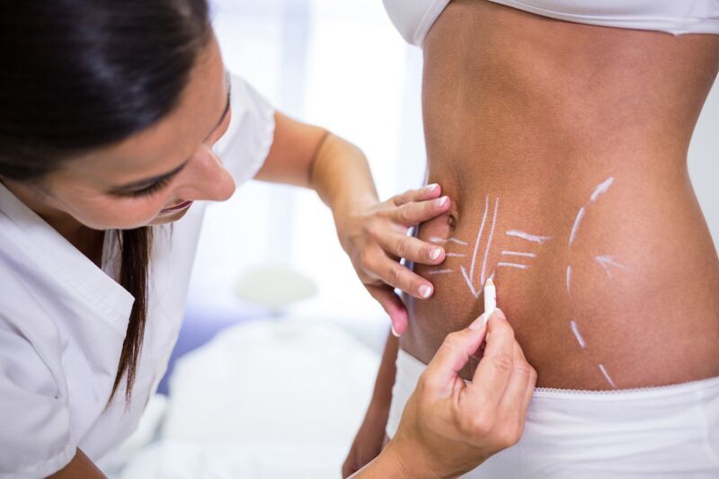Tummy Tuck / Abdominoplasty
