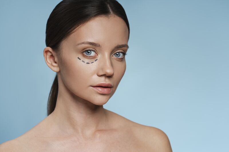 Lower Eyelid Blepharoplasty