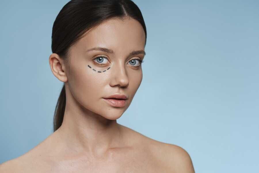 Endoscopic technic at eyebrow lift surgery