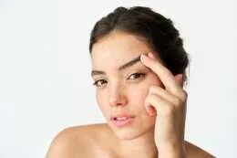 Brow Lift & Temple Lift Surgery