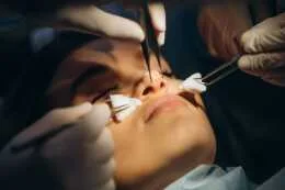 Ultrasonik (Piezo) Burun Estetiği