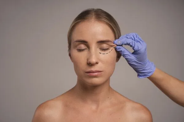 Upper Eyelid Blepharoplasty