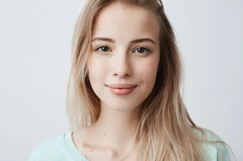 Corner Lip Lift (Smile Lift)